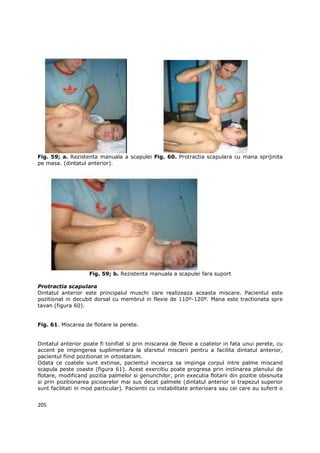 Fig. 59; a. Rezistenta manuala a scapulei Fig. 60. Protractia scapulara cu mana sprijinita
pe masa. (dintatul anterior).




                    Fig. 59; b. Rezistenta manuala a scapulei fara suport

Protractia scapulara
Dintatul anterior este principalul muschi care realizeaza aceasta miscare. Pacientul este
pozitionat in decubit dorsal cu membrul in flexie de 110º-120º. Mana este tractionata spre
tavan (figura 60).


Fig. 61. Miscarea de flotare la perete.


Dintatul anterior poate fi tonifiat si prin miscarea de flexie a coatelor in fata unui perete, cu
accent pe impingerea suplimentara la sfarsitul miscarii pentru a facilita dintatul anterior,
pacientul fiind pozitionat in ortostatism.
Odata ce coatele sunt extinse, pacientul incearca sa impinga corpul intre palme miscand
scapula peste coaste (figura 61). Acest exercitiu poate progresa prin inclinarea planului de
flotare, modificand pozitia palmelor si genunchilor, prin executia flotarii din pozitie obisnuita
si prin pozitionarea picioarelor mai sus decat palmele (dintatul anterior si trapezul superior
sunt facilitati in mod particular). Pacientii cu instabilitate anterioara sau cei care au suferit o


205
 