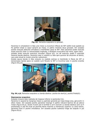 Fig. 63. Retractia scapulara cu greutati.

Pacientul in ortostatism in fata unei mese cu trunchiul inflexie de 90º astfel incat spatele sa
fie perfect drept si capul sprijinit pe masa; in palme mentine doua greutati. Din aceasta
pozitie executa abductia simultana a membrelor pana la 90º. Desi pacientul poate executa
acest exercitiu doar cu extremitatea implicata, o facilitare musculara mai mare, apare daca
ambele brate executa exercitiul simultan (figura 63). Un alt exercitiu poate fi executat
folosind banda elastica. Pacientul este in sezand cu fata spre punctul de ancorare al benzii,
care este situat la nivelul umerilor subiectului.
Acesta apuca banda in fata corpului cu coatele extinse si membrele in flexie de 45º si
tensioneaza banda pana ce coatele sunt flexate la 90º si trunchiul este in pozitie erectila
(figura 64,a,b).




Fig. 64; a,b. Retractia scapulara cu banda elastica: pozitia de start(a), pozitia finala(b).

Depresarea scapulara
Aceasta miscare este realizata de trapezul inferior si pectoralul mic.
Pacientul in sezand la marginea mesei cu palmele sprijinite pe masa langa corp, genunchii in
afara mesei. Din aceasta pozitie pacientul impinge in palme ridicand bazinul de pe planul
masei (figura 65,a). Acesti muschi pot fi tonifiati si prin exercitii cu banda elastica care va fi
pozitionata in asa fel incat sa permita flexia maxima a membrului superior cu cotul extins,
pacientul fiind in pozitie ortostatica. Din aceasta pozitie subiectul trage de scapula in jos
(figura 65,b).




207
 