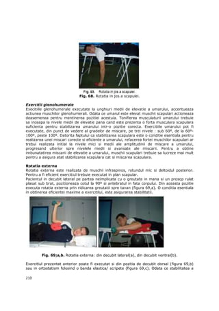 Fig. 68. Rotatia in jos a scapulei.

Exercitii glenohumerale
Execitiile glenohumerale executate la unghiuri medii de elevatie a umarului, accentueaza
actiunea muschilor glenohumerali. Odata ce umarul este elevat muschii scapulari actioneaza
deasemenea pentru mentinerea pozitiei acestuia. Tonifierea musculaturii umarului trebuie
sa inceapa la nivele medii de elevatie pana cand este prezenta o forta musculara scapulara
suficienta pentru stabilizarea umarului intr-o pozitie corecta. Exercitiile umarului pot fi
executate, din punct de vedere al gradelor de miscare, pe trei nivele : sub 60º, de la 60º-
100º, peste 100º. Datorita faptului ca stabilizarea scapulara este o conditie esentiala pentru
realizarea unei miscari corecte si eficiente a umarului, refacerea fortei muschilor scapulari ar
trebui realizata initial la nivele mici si medii ale amplitudinii de miscare a umarului,
progresand ulterior spre nivelele medii si avansate ale miscarii. Pentru a obtine
imbunatatirea miscarii de elevatie a umarului, muschii scapulari trebuie sa lucreze mai mult
pentru a asigura atat stabilizarea scapulara cat si miscarea scapulara.

Rotatia externa
Rotatia externa este realizata de muschii infraspinos, rotundul mic si deltoidul posterior.
Pentru a fi eficient exercitiul trebuie executat in plan scapular.
Pacientul in decubit lateral pe partea neimplicata cu o greutate in mana si un prosop rulat
plasat sub brat, pozitioneaza cotul la 90º si antebratul in fata corpului. Din aceasta pozitie
executa rotatia externa prin ridicarea greutatii spre tavan (figura 69,a). O conditia esentiala
in obtinerea eficientei maxime a exercitilui, este asigurarea stabilitatii.




         Fig. 69;a,b. Rotatia externa: din decubit lateral(a), din decubit ventral(b).

Exercitiul prezentat anterior poate fi executat si din pozitia de decubit dorsal (figura 69,b)
sau in ortostatism folosind o banda elastica/ scripete (figura 69,c). Odata ce stabilitatea a

210
 