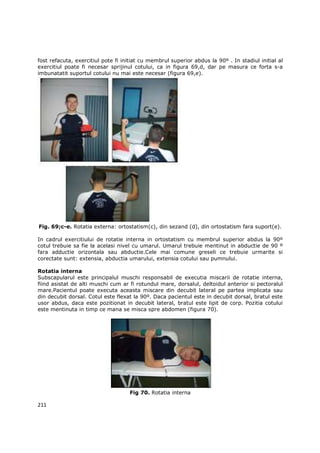 fost refacuta, exercitiul pote fi initiat cu membrul superior abdus la 90º . In stadiul initial al
exercitiul poate fi necesar sprijinul cotului, ca in figura 69,d, dar pe masura ce forta s-a
imbunatatit suportul cotului nu mai este necesar (figura 69,e).




Fig. 69;c-e. Rotatia externa: ortostatism(c), din sezand (d), din ortostatism fara suport(e).

In cadrul exercitiului de rotatie interna in ortostatism cu membrul superior abdus la 90º
cotul trebuie sa fie la acelasi nivel cu umarul. Umarul trebuie mentinut in abductie de 90 º
fara adductie orizontala sau abductie.Cele mai comune greseli ce trebuie urmarite si
corectate sunt: extensia, abductia umarului, extensia cotului sau pumnului.

Rotatia interna
Subscapularul este principalul muschi responsabil de executia miscarii de rotatie interna,
fiind asistat de alti muschi cum ar fi rotundul mare, dorsalul, deltoidul anterior si pectoralul
mare.Pacientul poate executa aceasta miscare din decubit lateral pe partea implicata sau
din decubit dorsal. Cotul este flexat la 90º. Daca pacientul este in decubit dorsal, bratul este
usor abdus, daca este pozitionat in decubit lateral, bratul este lipit de corp. Pozitia cotului
este mentinuta in timp ce mana se misca spre abdomen (figura 70).




                                    Fig 70. Rotatia interna

211
 