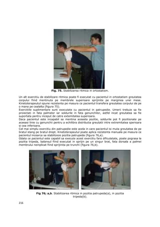 Fig. 75. Stabilizarea ritmica in ortostatism.

Un alt exercitiu de stabilizare ritmica poate fi executat cu pacientul in ortostatism greutatea
corpului fiind mentinuta pe membrele superioare sprijinite pe marginea unei mese.
Kinetoterapeutul opune rezistenta pe masura ce pacientul transfera greutatea corpului de pe
o mana pe cealalta (figura 75).
Exercitiile suplimentare sunt executate cu pacientul in patrupedie. Umerii trebuie sa fie
proiectati in fata palmelor iar soldurile in fata genunchilor, astfel incat greutatea sa fie
suportata pentru inceput de catre extemitatea superioara.
Daca pacientul este incapabil sa mentina aceasta pozitie, soldurile pot fi pozitionate pe
aceeasi linie cu genunchii pentru a echilibra distributia greutatii intre extremitatea sperioara
si cea inferioara.
Cel mai simplu exercitiu din patrupedie este acela in care pacientul isi muta greutatea de pe
bratul stang pe bratul drept. Kinetoterapeutul poate aplica rezistenta manuala pe masura ce
pacientul incearca sa stabilizeze pozitia patrupeda (figura 76,a).
Odata ce pacientul este capabil sa execute acest exercitiu fara dificulatate, poate pograsa la
pozitia tripeda, balansul fiind executat in sprijin pe un singur brat, fata dorsala a palmei
membrului neinplicat fiind sprijinita pe trunchi (figura 76,b).




             Fig 76; a,b. Stabilizarea ritmica in pozitia patrupeda(a), in pozitia
                                          tripeda(b).

216
 