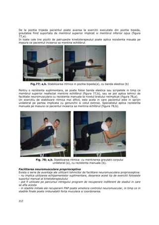 De la pozitia tripeda pacientul poate avansa la exercitii executate din pozitie bipeda,
greutatea fiind suportata de membrul superior implicat si membrul inferior opus (figura
77,a).
In toate cele trei pozitii de patrupedie kinetoterapeutul poate aplica rezistenta mauala pe
masura ce pacientul incearca sa mentina echilibrul.




         Fig.77; a,b. Stabilizarea ritmica in pozitia bipeda(a), cu banda elastica (b)

Pentru o rezistenta suplimentara, se poate folosi banda elastica sau scripetele in timp ce
membrul superior neafectat mentine echilibrul (figura 77,b), sau se pot aplica tehnici de
facilitate neuromusculara cu rezistenta manuala la nivelul bratului neimplicat (figura 78,a).
Un exercitiu de stabilizare ritmica mai dificil, este acela in care pacientul este in sprijin
unilateral pe partea implicata cu genunchii si cotul extinse. Specialistul aplica rezistenta
manuala pe masura ce pacientul incearca sa mentina echlibrul (figura 78,b).




             Fig. 78; a,b. Stabilizarea ritmica: cu mentinerea greutatii corpului
                          unilateral (a), cu rezistenta manuala (b).

Facilitarea neuromusculara proprioceptiva
Exista o serie de avantaje ale utilizarii tehnicilor de facilitare neuromusculara proprioceptiva:
- nu implica utilizarea echipamentelor suplimentare, deoarece acest tip de exercitii foloseste
suportul manual al kinetoterapeutului
- pot fi utilizate pe parcursul intregului program de recuperare indiferent de stadiul in care
se afla acesta
- in stadiile initiale ale recuperarii FNP poate ameliora controlul neuromuscular, in timp ce in
stadiile finale poate imbunatatii forta muculara si coordonarea.


217
 