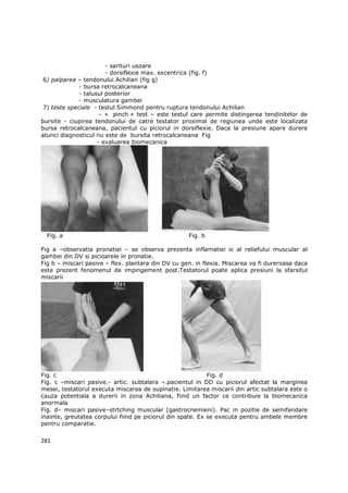 - sarituri usoare
                        - dorsiflexie max. excentrica (fig. f)
 6) palparea – tendonului Achilian (fig g)
              - bursa retrocalcaneana
              - talusul posterior
              - musculatura gambei
 7) teste speciale - testul Simmond pentru ruptura tendonului Achilian
                      - « pinch » test – este testul care permite distingerea tendinitelor de
bursite - ciupirea tendonului de catre testator proximal de regiunea unde este localizata
bursa retrocalcaneana, pacientul cu piciorul in dorsiflexie. Daca la presiune apare durere
atunci diagnosticul nu este de bursita retrocalcaneana Fig
                     - evaluarea biomecanica




  Fig. a                                            Fig. b

Fig a –observatia pronatiei – se observa prezenta inflamatiei si al reliefului muscular al
gambei din DV si picioarele in pronatie.
Fig b – miscari pasive – flex. plantara din DV cu gen. in flexia. Miscarea va fi dureroasa daca
este prezent fenomenul de impingement post.Testatorul poate aplica presiuni la sfarsitul
miscarii




Fig. c                                                      Fig. d
Fig. c –miscari pasive.- artic. subtalara –.pacientul in DD cu piciorul afectat la marginea
mesei, testatorul executa miscarea de supinatie. Limitarea miscarii din artic subtalara este o
cauza potentiala a durerii in zona Achiliana, fiind un factor ce contribuie la biomecanica
anormala
Fig. d– miscari pasive–strtching muscular (gastrocnemieni). Pac in pozitie de semifandare
inainte, greutatea corpului fiind pe piciorul din spate. Ex se executa pentru ambele membre
pentru comparatie.


281
 