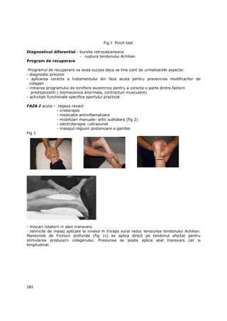 Fig I Pinch test

Diagnosticul diferential - bursita retrocalcaneana
                           - ruptura tendonului Achilian
Program de recuperare

 Programul de recuperare va avea succes daca se tine cont de urmatoarele aspecte:
- diagnostic precoce
- aplicarea corecta a tratamentului din faza acuta pentru prevenirea modificarilor de
  colagen
- initierea programului de tonifiere excentrica pentru a corecta o parte dintre factorii
   predispozanti ( biomecanica anormala, contracturi musculare)
- activitati functionale specifice sportului practicat

FAZA I acuta - repaus rexact
               - crioterapie
               - medicatie antiinflamatoare
               - mobilizari manuale- artic subtalara (fig 2)
               - electroterapie –ultrasunet
               - masajul regiunii posterioare a gambei
Fig 1




- miscari rotatorii in plan transvers
- tehnicile de masaj aplicate la nivelul m triceps sural reduc tensiunea tendonului Achilian.
Manevrele de frictiuni profunde (fig 1c) se aplica direct pe tendonul afectat pentru
stimularea producerii colagenului. Presiunea se poate aplica atat transvers cat si
longitudinal.




283
 