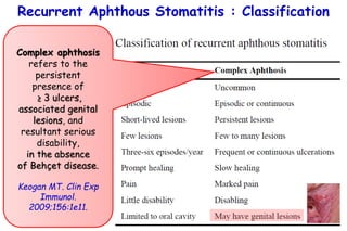 Major Ras Recurrent aphthous stomatitis | PPTX