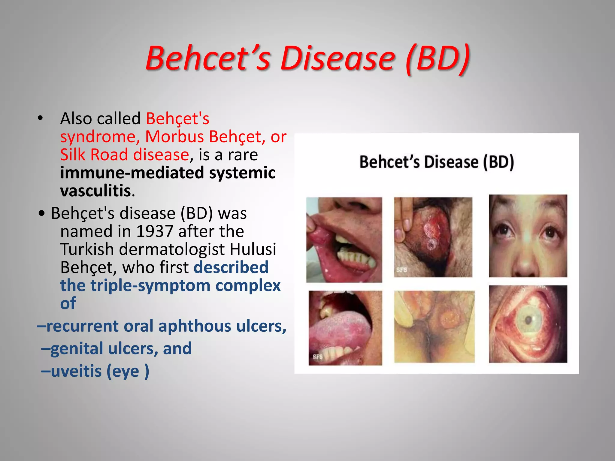 Allergic and Immunologic Diseases of Oral Cavity | PPTX