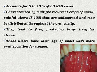 Major Ras Recurrent aphthous ulcers (RAS).pptx