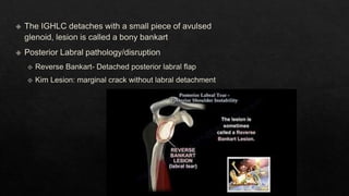 Recurrent Dislocation of Shoulder.pptx