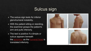 Recurrent Dislocation of Shoulder.pptx
