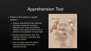 Recurrent Dislocation of Shoulder.pptx