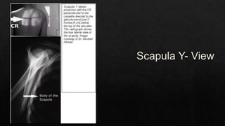 Recurrent Dislocation of Shoulder.pptx