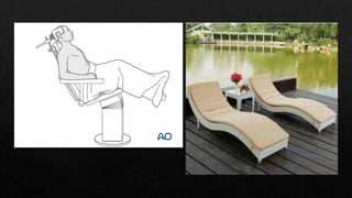 Recurrent Dislocation of Shoulder.pptx