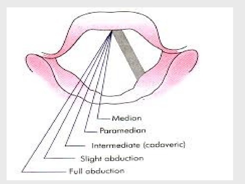Recurrent laryngeal nerve paralysis