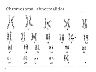 Chromosomal abnormalities
 