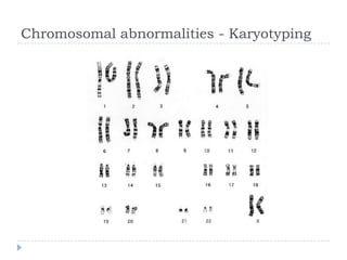 Chromosomal abnormalities - Karyotyping
 