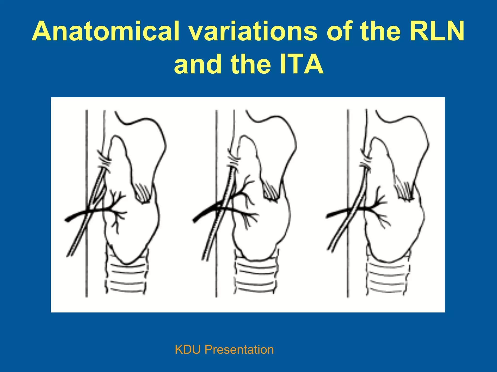 Course Of Rln Recurrent Laryngeal Nerve and thyroid surgery | PDF