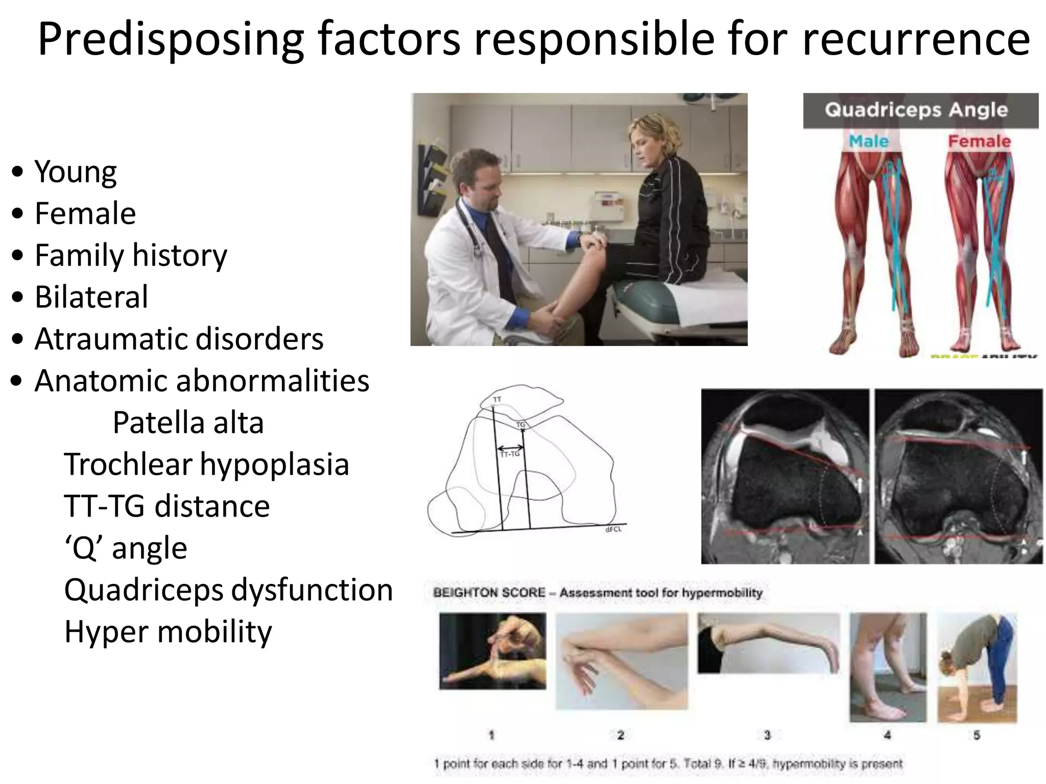 • Young
• Female
• Family history
• Bilateral
• Atraumatic disorders
• Anatomic abnormalities
Patella alta
Trochlear hypoplasia
TT-TG distance
‘Q’ angle
Quadriceps dysfunction
Hyper mobility
Predisposing factors responsible for recurrence
 