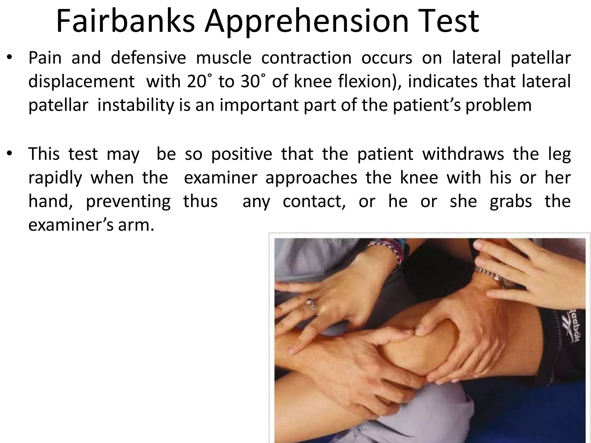 Fairbanks Apprehension Test
• Pain and defensive muscle contraction occurs on lateral patellar
displacement with 20˚ to 30˚ of knee flexion), indicates that lateral
patellar instability is an important part of the patient’s problem
• This test may be so positive that the patient withdraws the leg
rapidly when the examiner approaches the knee with his or her
hand, preventing thus any contact, or he or she grabs the
examiner’s arm.
 