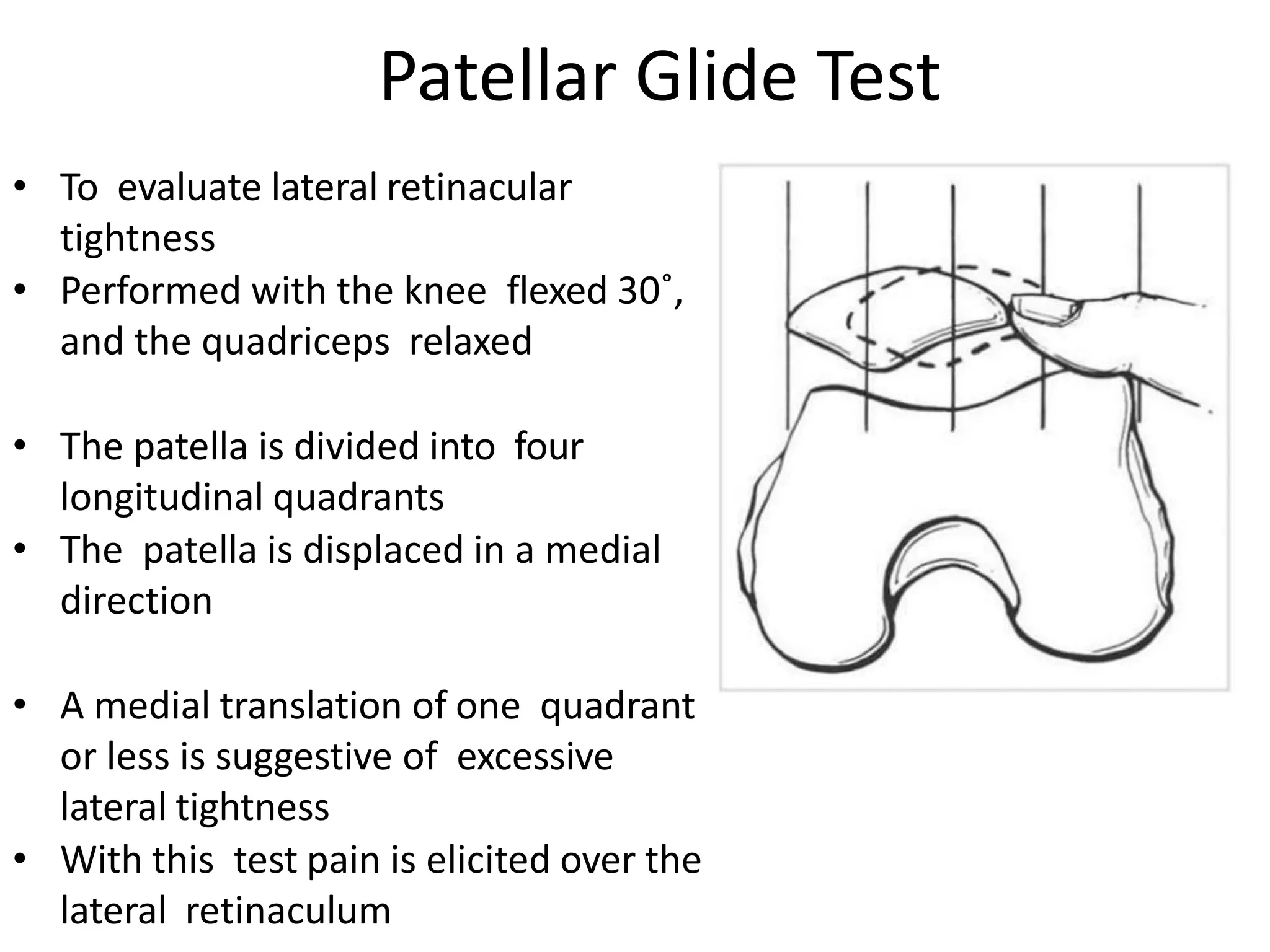 • To evaluate lateral retinacular
tightness
• Performed with the knee flexed 30˚,
and the quadriceps relaxed
• The patella is divided into four
longitudinal quadrants
• The patella is displaced in a medial
direction
• A medial translation of one quadrant
or less is suggestive of excessive
lateral tightness
• With this test pain is elicited over the
lateral retinaculum
Patellar Glide Test
 
