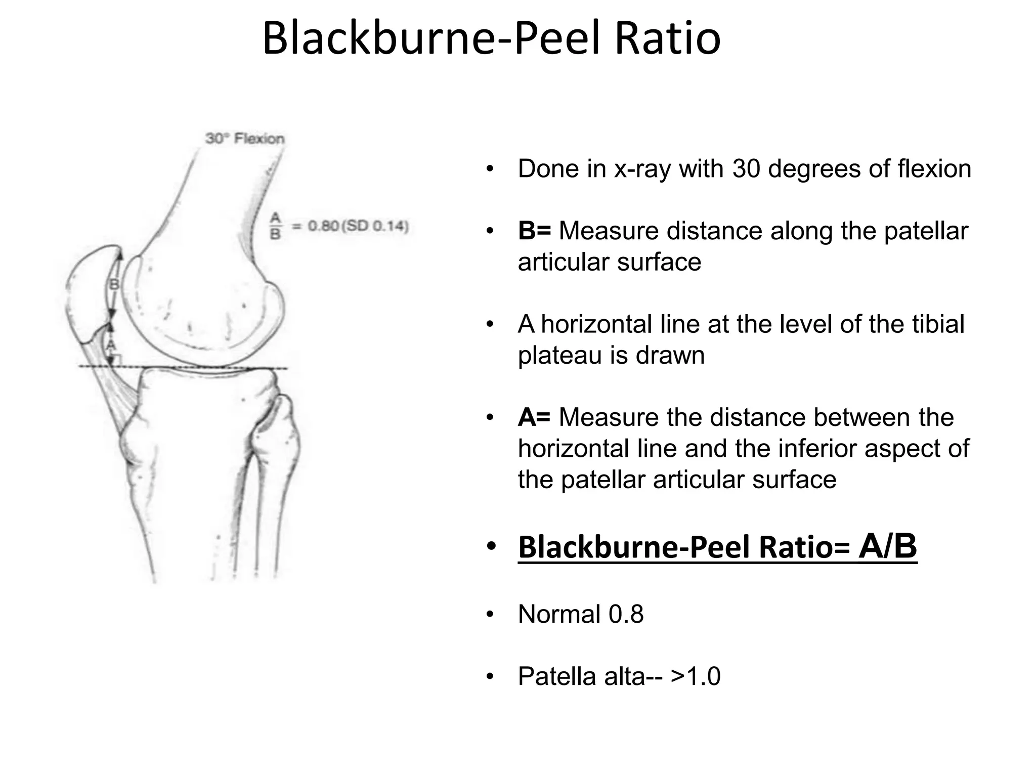 Blackburne-Peel Ratio
• Done in x-ray with 30 degrees of flexion
• B= Measure distance along the patellar
articular surface
• A horizontal line at the level of the tibial
plateau is drawn
• A= Measure the distance between the
horizontal line and the inferior aspect of
the patellar articular surface
• Blackburne-Peel Ratio= A/B
• Normal 0.8
• Patella alta-- >1.0
 