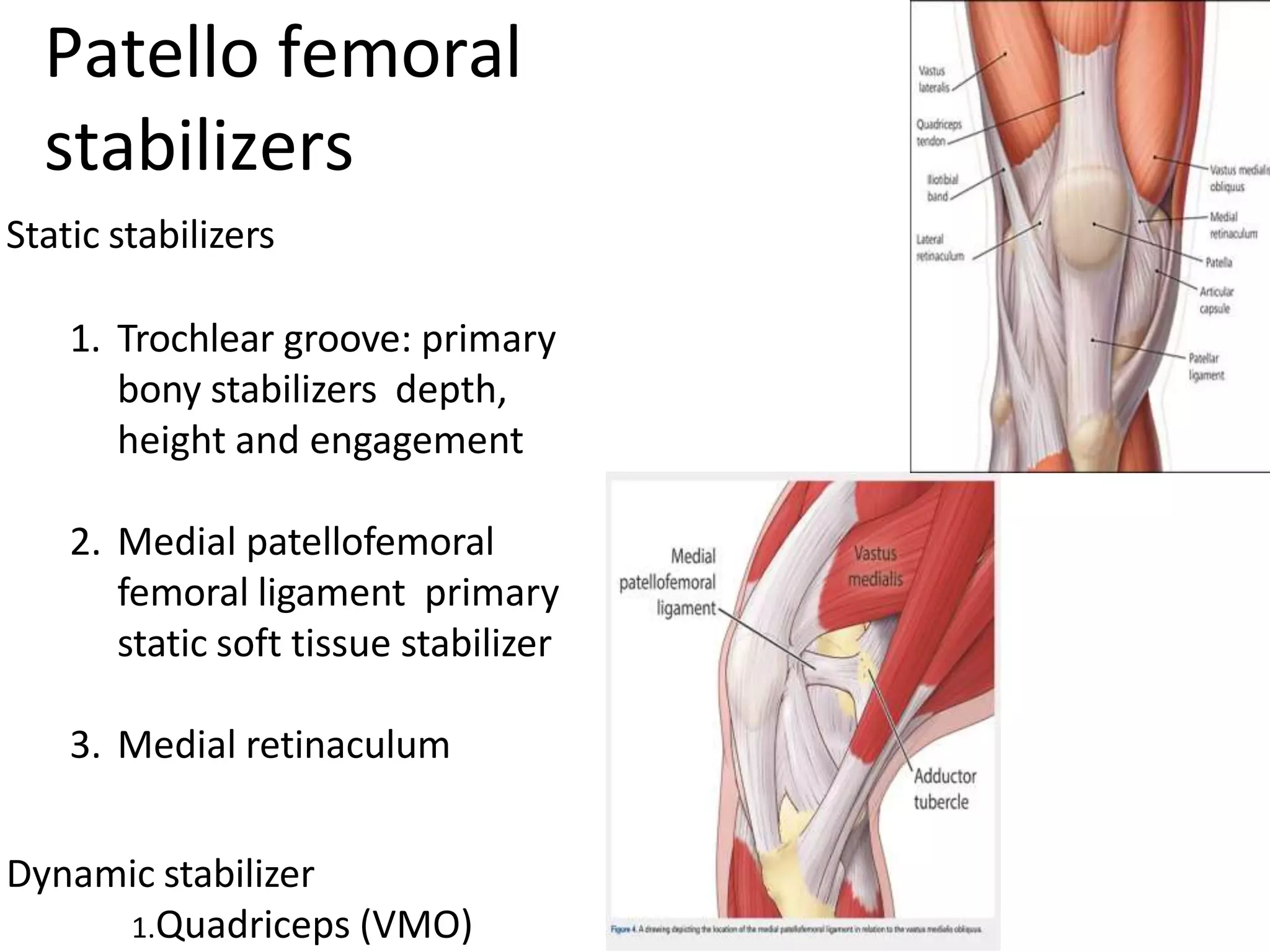 Static stabilizers
1. Trochlear groove: primary
bony stabilizers depth,
height and engagement
2. Medial patellofemoral
femoral ligament primary
static soft tissue stabilizer
3. Medial retinaculum
Dynamic stabilizer
1.Quadriceps (VMO)
Patello femoral
stabilizers
 