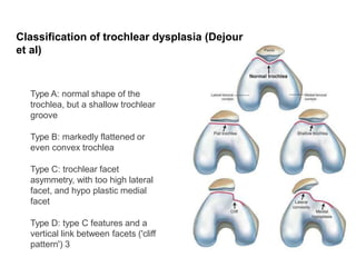 Type A: normal shape of the
trochlea, but a shallow trochlear
groove
Type B: markedly flattened or
even convex trochlea
Type C: trochlear facet
asymmetry, with too high lateral
facet, and hypo plastic medial
facet
Type D: type C features and a
vertical link between facets ('cliff
pattern') 3
Classification of trochlear dysplasia (Dejour
et al)
 