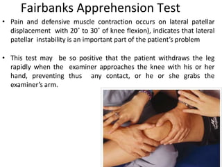 Fairbanks Apprehension Test
• Pain and defensive muscle contraction occurs on lateral patellar
displacement with 20˚ to 30˚ of knee flexion), indicates that lateral
patellar instability is an important part of the patient’s problem
• This test may be so positive that the patient withdraws the leg
rapidly when the examiner approaches the knee with his or her
hand, preventing thus any contact, or he or she grabs the
examiner’s arm.
 