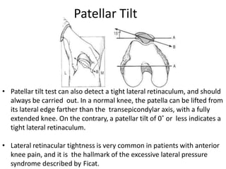 • Patellar tilt test can also detect a tight lateral retinaculum, and should
always be carried out. In a normal knee, the patella can be lifted from
its lateral edge farther than the transepicondylar axis, with a fully
extended knee. On the contrary, a patellar tilt of 0˚ or less indicates a
tight lateral retinaculum.
• Lateral retinacular tightness is very common in patients with anterior
knee pain, and it is the hallmark of the excessive lateral pressure
syndrome described by Ficat.
Patellar Tilt
 