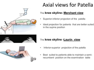 The knee skyline- Merchant view
• Superior-inferior projection of the patella
• Ideal projection for patients that are better suited
in the supine position
The knee skyline -Laurin view
• Inferior-superior projection of the patella
• Best suited to patients able to maintain a semi-
recumbent position on the examination table
Axial views for Patella
 