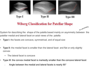 System for describing the shape of the patella based mainly on asymmetry between the
patellar medial and lateral facet on axial views of the patella
• Type I: the facets are concave, symmetrical, and of equal size
• Type II: the medial facet is smaller than the lateral facet and flat or only slightly
convex
• The lateral facet is concave
• Type III: the convex medial facet is markedly smaller than the concave lateral facet
• Angle between the medial and lateral facets is nearly 90°
 