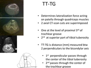TT-TG
• Determines lateralization force acting
on patella through quadriceps muscles
• 2 axial CT-scan cuts are superimposed
• One at the level of proximal 3rd of
trochlear groove
• 2nd at superior part of tibial tuberosity
• TT-TG is distance (mm) measured btw
2 perpendiculars to the bicondylar axis
• 1st perpendicular passes through
the center of the tibial tuberosity
• 2nd passes through the center of
the trochlear groove
 