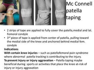 • 2 strips of tape are applied to fully cover the patella,medial and lat.
Femoral condyle
• 3rd piece of tape is applied from center of patella, pulling toward
the medial side of the knee and anchored behind medial fem.
condyle
Indications
With certain knee injuries – such as patellofemoral pain syndrome
where abnormal patella tracking is contributing to the injury.
Toprevent injury or injury aggravation – Patella taping maybe
beneficial during sports or activities that place the knee at-risk of
injury or injury aggravation
Mc Connell
patella
taping
 