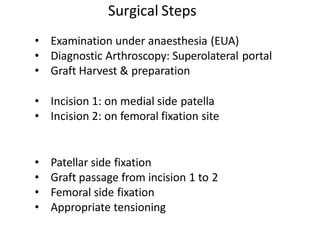 • Examination under anaesthesia (EUA)
• Diagnostic Arthroscopy: Superolateral portal
• Graft Harvest & preparation
• Incision 1: on medial side patella
• Incision 2: on femoral fixation site
• Patellar side fixation
• Graft passage from incision 1 to 2
• Femoral side fixation
• Appropriate tensioning
Surgical Steps
 