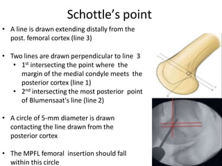 • A line is drawn extending distally from the
post. femoral cortex (line 3)
• Two lines are drawn perpendicular to line 3
• 1st intersecting the point where the
margin of the medial condyle meets the
posterior cortex (line 1)
• 2nd intersecting the most posterior point
of Blumensaat's line (line 2)
• A circle of 5-mm diameter is drawn
contacting the line drawn from the
posterior cortex
• The MPFL femoral insertion should fall
within this circle
Schottle’s point
 