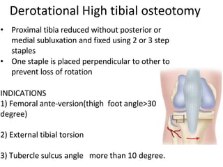Derotational High tibial osteotomy
• Proximal tibia reduced without posterior or
medial subluxation and fixed using 2 or 3 step
staples
• One staple is placed perpendicular to other to
prevent loss of rotation
INDICATIONS
1) Femoral ante-version(thigh foot angle>30
degree)
2) External tibial torsion
3) Tubercle sulcus angle more than 10 degree.
 