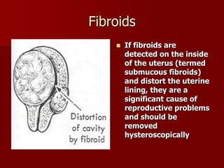 Fibroids
 If fibroids are
detected on the inside
of the uterus (termed
submucous fibroids)
and distort the uterine
lining, they are a
significant cause of
reproductive problems
and should be
removed
hysteroscopically
 
