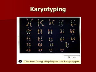 Karyotyping
 