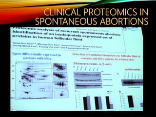 CLINICAL PROTEOMICS IN
SPONTANEOUS ABORTIONS
 