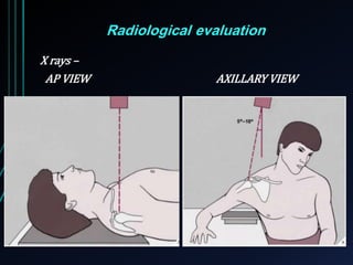 Radiological evaluation 
X rays – 
AP VIEW AXILLARY VIEW 
 