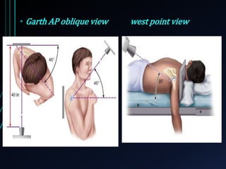 • Garth AP oblique view west point view 
 