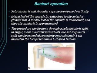 Bankart operation 
• Subscapularis and shoulder capsule are opened vertically 
• lateral leaf of the capsule is reattached to the anterior 
glenoid rim. A medial leaf of the capsule is imbricated, and 
the subscapularis is approximated 
• The procedure can be done through a subscapularis split, 
in larger, more muscular individuals, the subscapularis 
split can be extended superiorly approximately 1 cm 
medial to the biceps tendon in L shaped fashion 
 