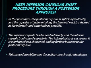 NEER INFERIOR CAPSULAR SHIFT 
PROCEDURE THROUGH A POSTERIOR 
APPROACH 
• In this procedure, the posterior capsule is split longitudinally, 
and the capsular attachment along the humeral neck is released 
as far inferiorly and anteriorly as possible. 
• The superior capsule is advanced inferiorly, and the inferior 
capsule is advanced superiorly. The infraspinatus is cut so that it 
is overlapped and shortened, adding further buttress to the 
posterior capsule. 
• This procedure obliterates the axillary pouch and redundancy. 
 