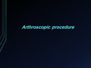 Arthroscopic procedure 
 