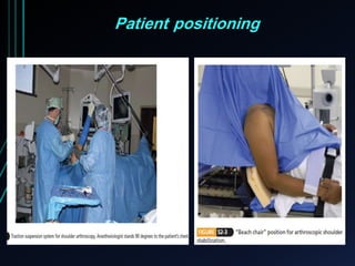 Patient positioning 
 