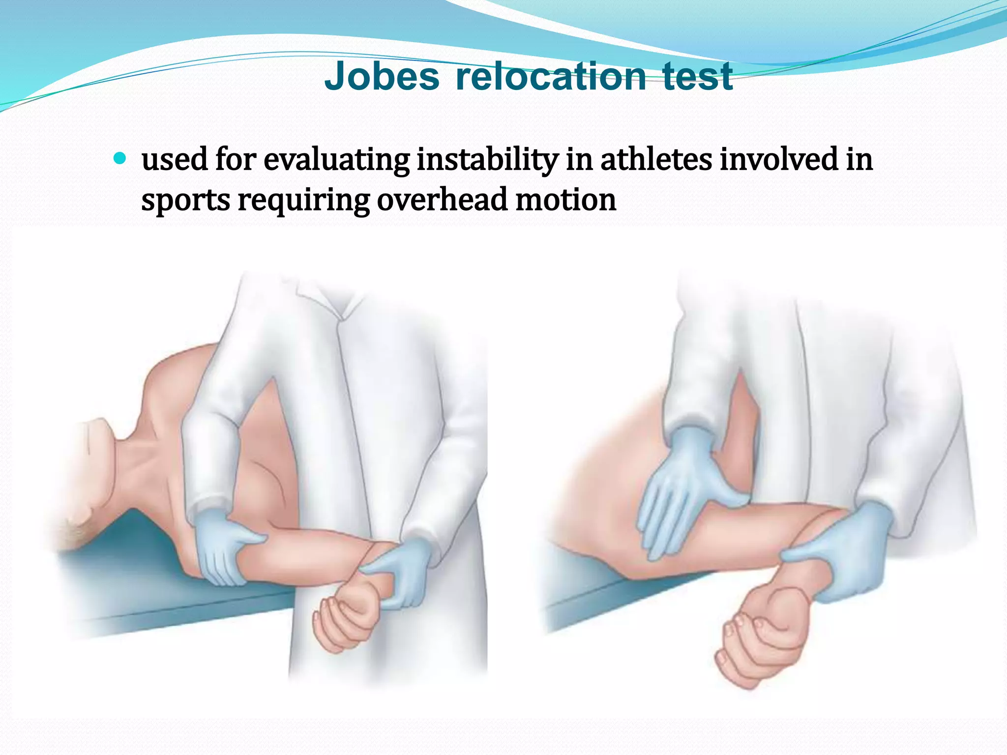Internal Rotation Relocation Test Recurrent Shoulder Dislocation | PPTX