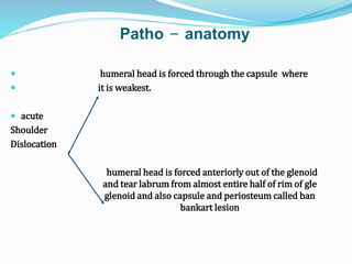 Patho - anatomy
 humeral head is forced through the capsule where
 it is weakest.
 acute
Shoulder
Dislocation
humeral head is forced anteriorly out of the glenoid
and tear labrum from almost entire half of rim of gle
glenoid and also capsule and periosteum called ban
bankart lesion
 