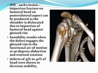  Hill – sach’s lesion –
impaction fracture on
humeral head on
posterolateral aspect can
be produced as the
shoulder is dislocated
due to impaction of
humeral head against
glenoid rim
 Instability results when
the defect engages the
glenoid rim in the
functional arc of motion
at 90 degrees abduction
and external rotation
 defects of 35% to 40% of
head were shown to
decrease stability,
 