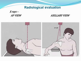 Radiological evaluation
X rays –
AP VIEW AXILLARY VIEW
 