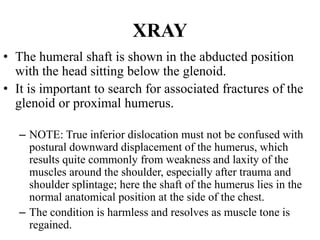 Shoulder Reduction Note Recurrent shoulder dislocation | PPTX