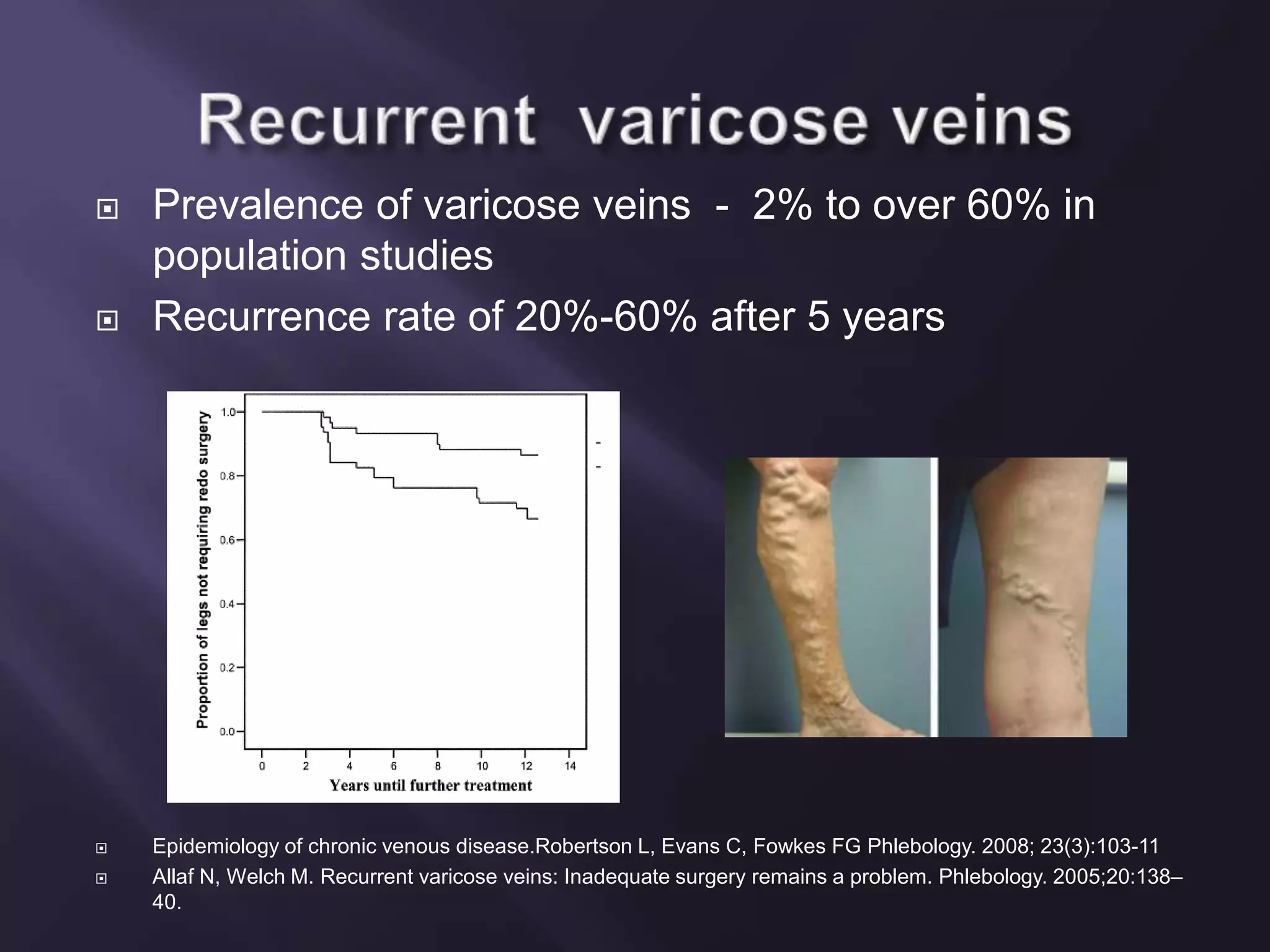 Recurrent varicose veins and its management | PPTX